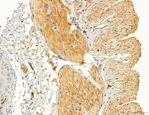Anti-TGF beta Receptor I antibody used in IHC (Paraffin sections) (IHC-P). GTX00840