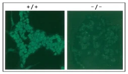 Anti-RAD18 antibody used in Immunocytochemistry/ Immunofluorescence (ICC/IF). GTX00887