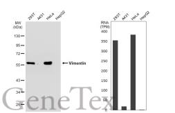 Anti-Vimentin antibody [GT1180] used in Western Blot (WB). GTX00942