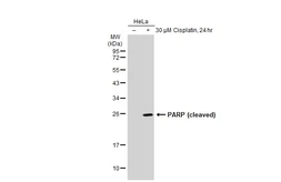 Anti-PARP (cleaved) antibody [GT1181] used in Western Blot (WB). GTX00943