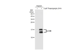 Anti-LC3B antibody [GT1187] used in Western Blot (WB). GTX00949