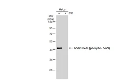 Anti-GSK3 beta (phospho Ser9) antibody [GT1209] used in Western Blot (WB). GTX00971