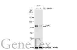 Anti-SP1 antibody [JF0950] used in Western Blot (WB). GTX01012