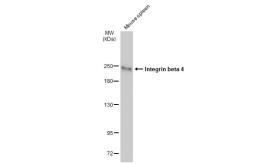 Anti-Integrin beta 4 antibody [JM11-06] used in Western Blot (WB). GTX01053