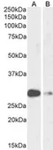 Anti-ASCL1 antibody used in Western Blot (WB). GTX01090