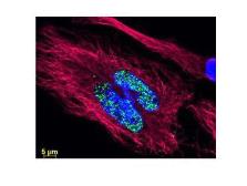 Donkey anti-Sheep IgG antibody (Dylight488), pre-adsorbed. GTX01134