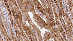 Anti-HSL (phospho Ser853) antibody used in IHC (Paraffin sections) (IHC-P). GTX01573