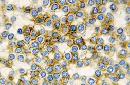 Anti-CD11c antibody [5D11] used in IHC (Paraffin sections) (IHC-P). GTX01849