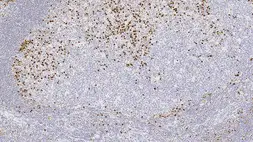 Anti-IRF4 / MUM1 antibody [EAU32] used in IHC (Paraffin sections) (IHC-P). GTX01894