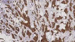 Anti-Cytokeratin 7 antibody [RN7] used in IHC (Paraffin sections) (IHC-P). GTX01903
