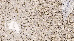Anti-CD13 antibody [38C12] used in IHC (Paraffin sections) (IHC-P). GTX01910