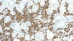 Anti-CD38 antibody [SPC32] used in IHC (Paraffin sections) (IHC-P). GTX01959