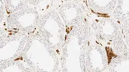 Anti-Calretinin antibody [CAL6] used in IHC (Paraffin sections) (IHC-P). GTX01973