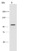 Anti-PSMD2 antibody used in Western Blot (WB). GTX02394