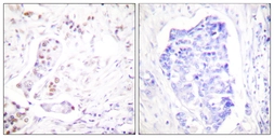 Anti-Cyclin A1 antibody used in IHC (Paraffin sections) (IHC-P). GTX02524
