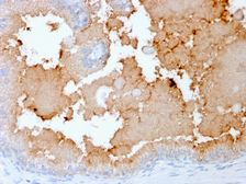 Anti-AKT1 antibody [rAKT1/2491] used in IHC (Paraffin sections) (IHC-P). GTX02583