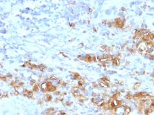 Anti-CA19-9 antibody [CA19.9/1390R] used in IHC (Paraffin sections) (IHC-P). GTX02763