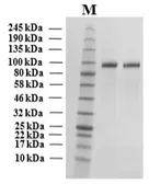 Human Autotaxin (mature) protein, His tag (active). GTX02798-pro
