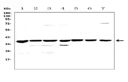 Anti-uPAR antibody used in Western Blot (WB). GTX03117