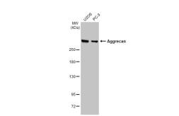 Anti-Aggrecan antibody [GT1267] used in Western Blot (WB). GTX03179