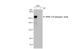 Anti-RPB1 CTD (phospho Ser2) antibody [GT1302] used in Western Blot (WB). GTX03214