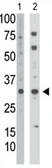 Anti-Thymidine Kinase 2 antibody used in Western Blot (WB). GTX03284