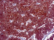 Anti-ADFP antibody [DBM15.60] used in IHC (Paraffin sections) (IHC-P). GTX03304