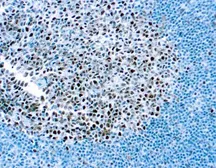 Anti-MSH2 antibody [DBM15.82] used in IHC (Paraffin sections) (IHC-P). GTX03307