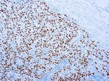 Anti-SOX10 antibody [EP268] used in IHC (Paraffin sections) (IHC-P). GTX03312