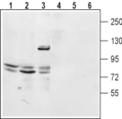 Anti-TPCN2 antibody used in Western Blot (WB). GTX03430