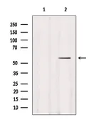Anti-DFNA5 antibody used in Western Blot (WB). GTX03443