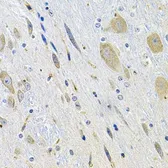 Anti-LGR6 antibody used in IHC (Paraffin sections) (IHC-P). GTX03496