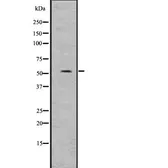 Anti-Suppressor of Fused antibody used in Western Blot (WB). GTX03498