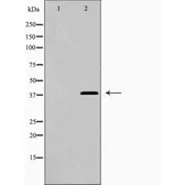 Anti-Galectin 9 antibody used in Western Blot (WB). GTX03644