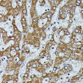 Anti-Apolipoprotein CIII antibody used in IHC (Paraffin sections) (IHC-P). GTX03650