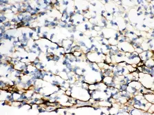 Anti-Versican antibody used in IHC (Paraffin sections) (IHC-P). GTX03733