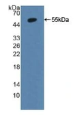 Mouse Annexin II protein, His and TrxA tag. GTX03782-pro
