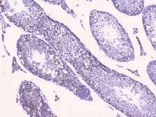 Anti-PTP1B antibody used in IHC (Paraffin sections) (IHC-P). GTX04098