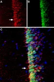 Anti-ADCY3 antibody used in IHC (Free Floating) (IHC (Free Floating)). GTX04114