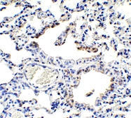 Anti-NCOA4 antibody used in IHC (Paraffin sections) (IHC-P). GTX04250
