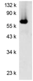 Anti-Firefly Luciferase antibody [Luci17] used in Western Blot (WB). GTX04313