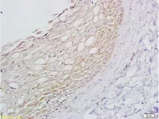 Anti-beta 1 Adrenergic Receptor antibody used in IHC (Paraffin sections) (IHC-P). GTX04321
