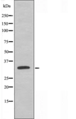 Anti-ACER2 antibody used in Western Blot (WB). GTX04335
