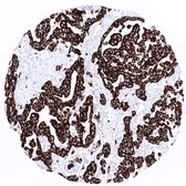 Anti-Cytokeratin 19 antibody [MSVA-119M] HistoMAX&trade; used in IHC (Paraffin sections) (IHC-P). GTX04378