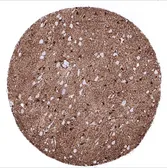 Anti-S100 beta antibody [MSVA-490R] HistoMAX&trade; used in IHC (Paraffin sections) (IHC-P). GTX04404