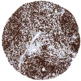Anti-TdT antibody [MSVA-453R] HistoMAX&trade; used in IHC (Paraffin sections) (IHC-P). GTX04417