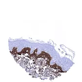 Anti-Periostin antibody [MSVA-649M] HistoMAX&trade; used in IHC (Paraffin sections) (IHC-P). GTX04460
