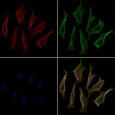 Anti-Vimentin antibody used in Immunocytochemistry/ Immunofluorescence (ICC/IF). GTX04497