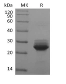 Human K-Ras (G12S mutant) protein, His tag. GTX04509-pro
