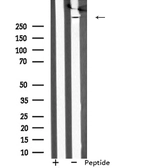 Anti-MAP1A antibody used in Western Blot (WB). GTX04514